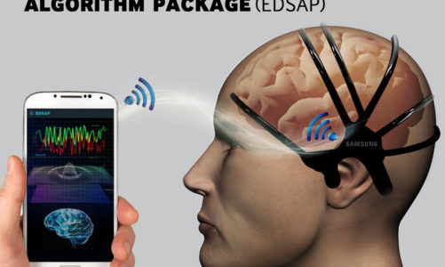 Samsung opracował sensor wykrywający nadchodzący udar mózgu