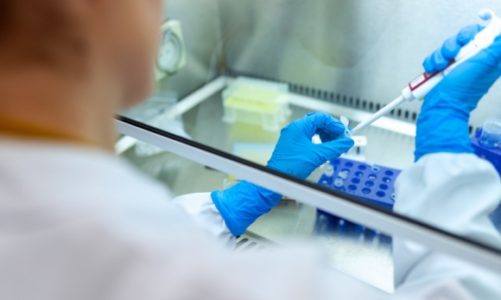 Sztuczna inteligencja przyśpieszy badania nad lekami i szczepionką na COVID-19